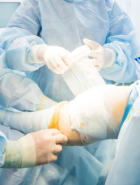 chirurgie membres inférieurs